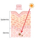 UVA damages to human skin. Beauty and heath care concept