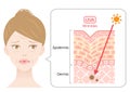 UVA radiation penetrate into skin on womanâs face that is resulting in winkles. Beauty and heath care concept