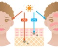 Infographic skin illustration. the difference between UVA and UVB rays penetration