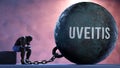 Uveitis and an alienated suffering human. A metaphor showing Uveitis as a huge prisoner's ball bringing pain and keeping