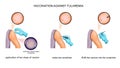 Vaccination against tularemia