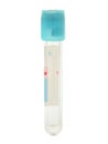 Vacuum blood collection tube with anticoagulant