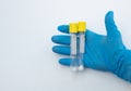Vacuum tube for collection and blood samples in blue glove. Royalty Free Stock Photo