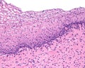 Vagina. Epithelium