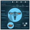 Vagina Infographic Infocharts Health And Medical Royalty Free Stock Photo