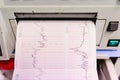 Valencia, Spain - October 25, 2018: Graphic with electrocardiogram of a pregnant woman during a hospital examination