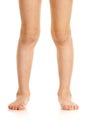 Valgus deformity of legs