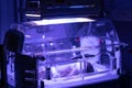 Newborn baby under ultraviolet lamp is getting treated for jaundice elevated bilirubin in Vancouver hospital