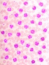 Variation of normal neutrophil cells or PMN cells in blood smear