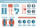 Varicose infographic. Venous disease medical health problems with human blood venous recent vector template set