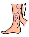 Varicose treatment icon. Violation of circulatory system. Vascular disease diagnostic. Venous insufficiency medical