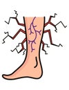 Varicose treatment icon. Violation of circulatory system. Vascular disease diagnostic. Venous insufficiency medical Royalty Free Stock Photo