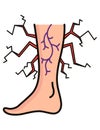 Varicose treatment icon. Violation of circulatory system. Vascular disease diagnostic. Venous insufficiency medical