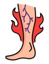 Varicose treatment icon. Violation of circulatory system. Vascular disease diagnostic. Venous insufficiency medical