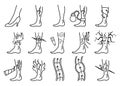 Varicose treatment icons set in coloring style. Violation of circulatory system. Vascular disease diagnostic. Venous