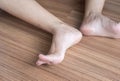 Varicose veins on the woman leg or foot,Body and health care concept,Selective focus Royalty Free Stock Photo