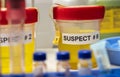 Various analyses of urine, saliva and blood of homicide suspects in crime lab