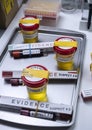 Various analyses of urine, saliva and blood of homicide suspects in crime lab