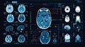 Computer Screen Displaying Multiple Brain Images Royalty Free Stock Photo