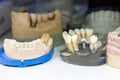 Various dental cast models. Focus on cast model with teeth implants