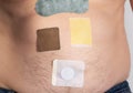 Various medical plasters are glued on the human body. Plaster from chronic prostatitis and painkiller. Anti-tobacco and