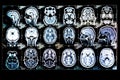 Various MRI scans showcasing different regions of the brain under a standard scale Royalty Free Stock Photo