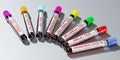 Various virus test tubes - 3D illustration Royalty Free Stock Photo