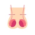 Vasectomy flat icon, vector illustration