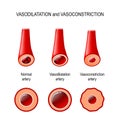 Vasodilation and vasoconstriction