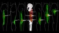 Vastus Lateralis Trigger Points. Leg pain. Release