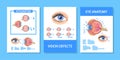 Vector Banners With Detailed Infographic Explaining Eye Anatomy, Vision Defects, And Astigmatism Royalty Free Stock Photo