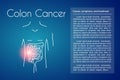 Vector Colon Cancer Blue Background