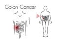 Vector Colon Cancer Linear Icon of Young Man Royalty Free Stock Photo