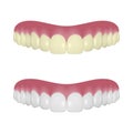 Vector 3d Realistic Render Denture Set Closeup Isolated on White Background. Dentistry and Orthodontics Design. Human Royalty Free Stock Photo
