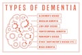 Vector dementia infographic in outline style. Editable illustration