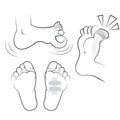 Vector - Examination of the foot. Vector illustration.