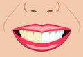 Vector face of girl and smile with bad and ideal teeth for dental and stomatological illustrations Royalty Free Stock Photo