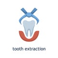 Vector flat icon of tooth extraction. Dental treatment