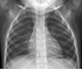 Vector flat icon x-ray of human thorax. Anatomy Royalty Free Stock Photo
