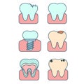 Vector flat illustration of teeth in various states. Healthy, diseased tooth