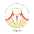 Vector isolated illustration of tooth