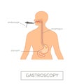 Vector gastroscopy concept