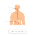 Vector gastroscopy concept