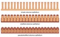 Three types of columnar epithelium with simple stratified and pseudostratified arrangement Royalty Free Stock Photo