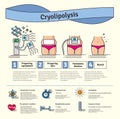 Vector Illustrated set with cosmetology Cryolipolysis treatment