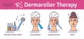 Vector Illustrated set with cosmetology Derma Roller therapy