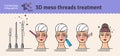 Vector Illustrated set with 3d Meso Thread face Lift therapy Royalty Free Stock Photo