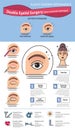 Vector Illustrated set with double eyelid surgery. Non-incisional technique