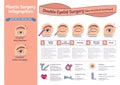 Vector Illustrated set with double eyelid surgery. Non-incisional technique