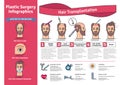 Vector Illustrated set with hair transplant surgery